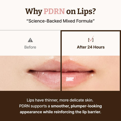 Advanced PDRN Rejuvenating Lip Serum 0.3 Fl Oz | Hydrating Lip Balm, Lipozip PDRN for Glowy, Dewy Lips, Gentle Exfoliating Lip Moisturizer, with Hibiscus & Lactic Acid